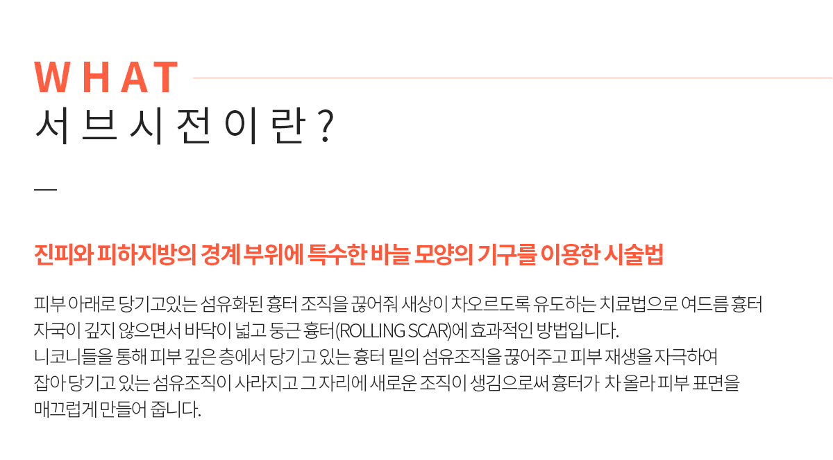 서브시전이란