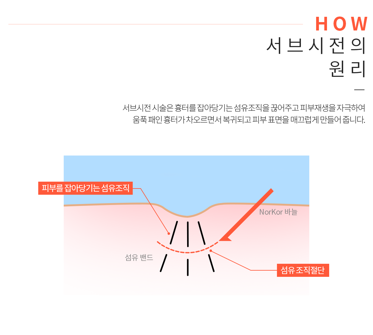 서브시전의 원리