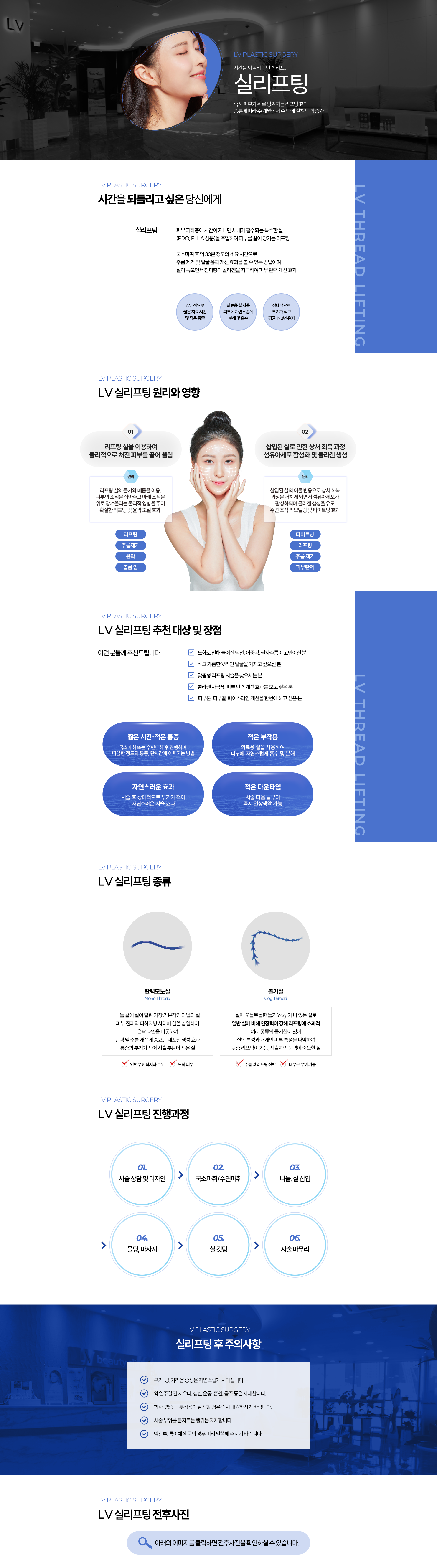 실크로드 리프팅 시술과정