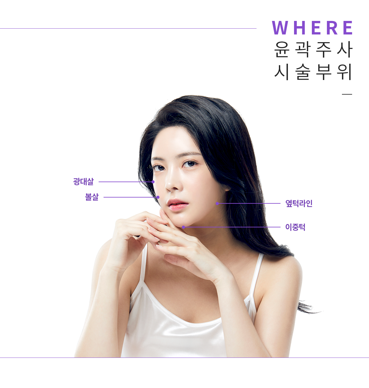 윤곽주사 시술부위