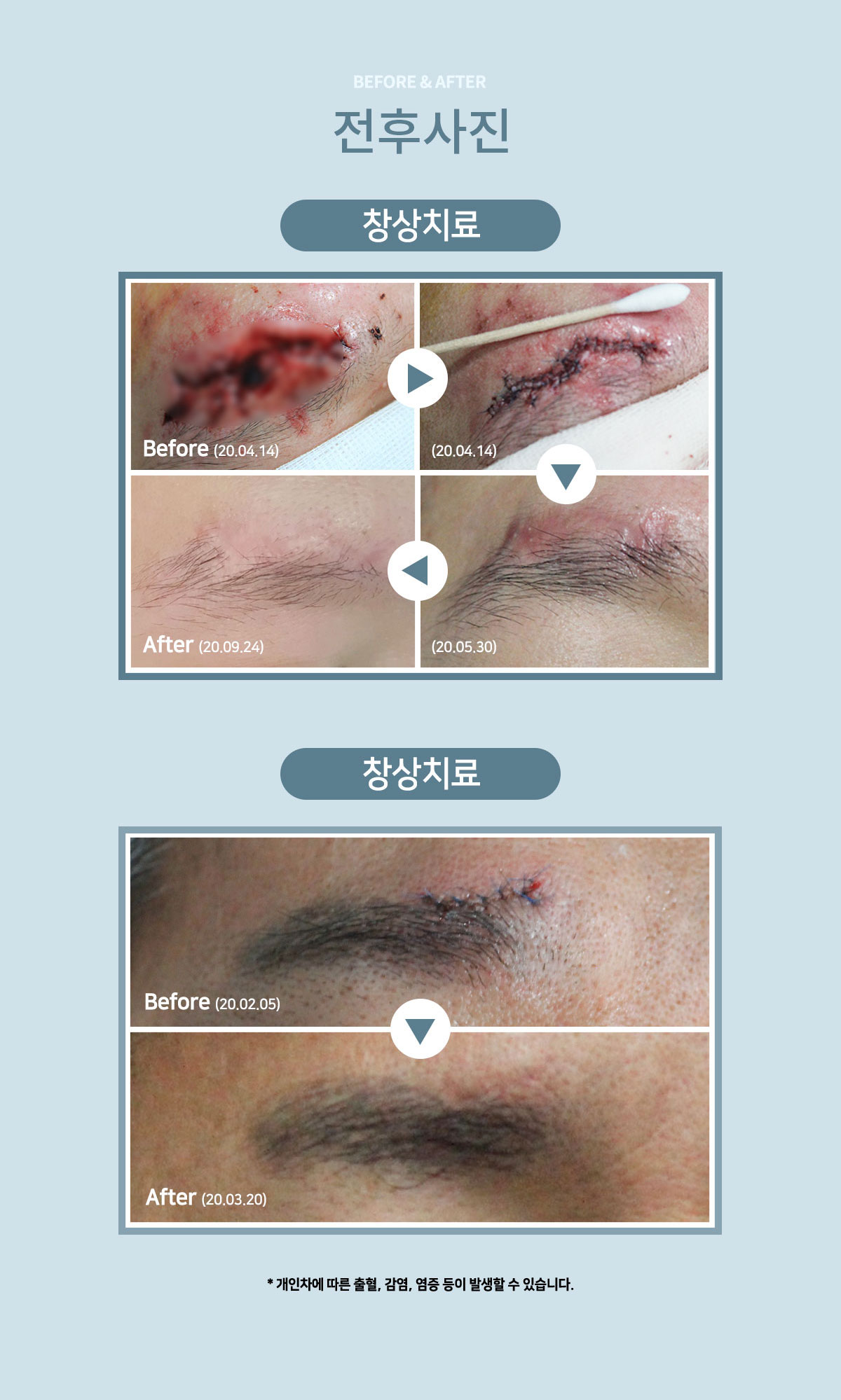 â�� ���Ļ���